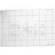 Beattie Intenscreen with 1 cm Grid Lines