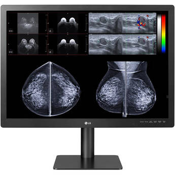 LG 31HN713D-B 31" 12MP Diagnostic Monitor