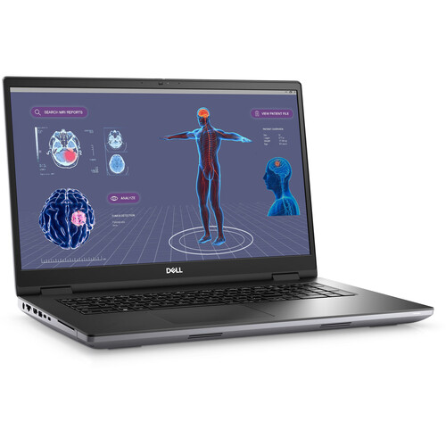 Dell 17