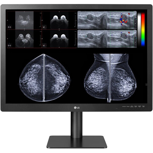LG 31HN713D-B 31" 12MP Diagnostic Monitor