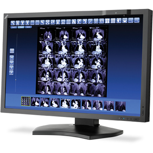 NEC MD302C4 30" Widescreen 4MP LED-Backlight Mid-Brightness Diagnostic Color Monitor