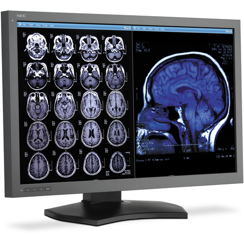 NEC MD302C6 30" LED Backlit IPS Diagnostic Monitor