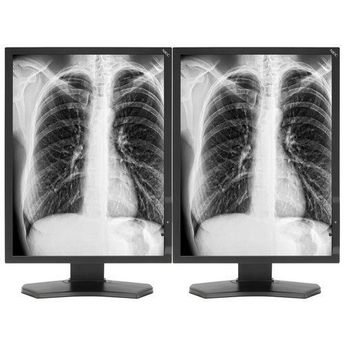 NEC 2 x 21" Grayscale Medical Diagnostic Monitors with MDN Graphics Card